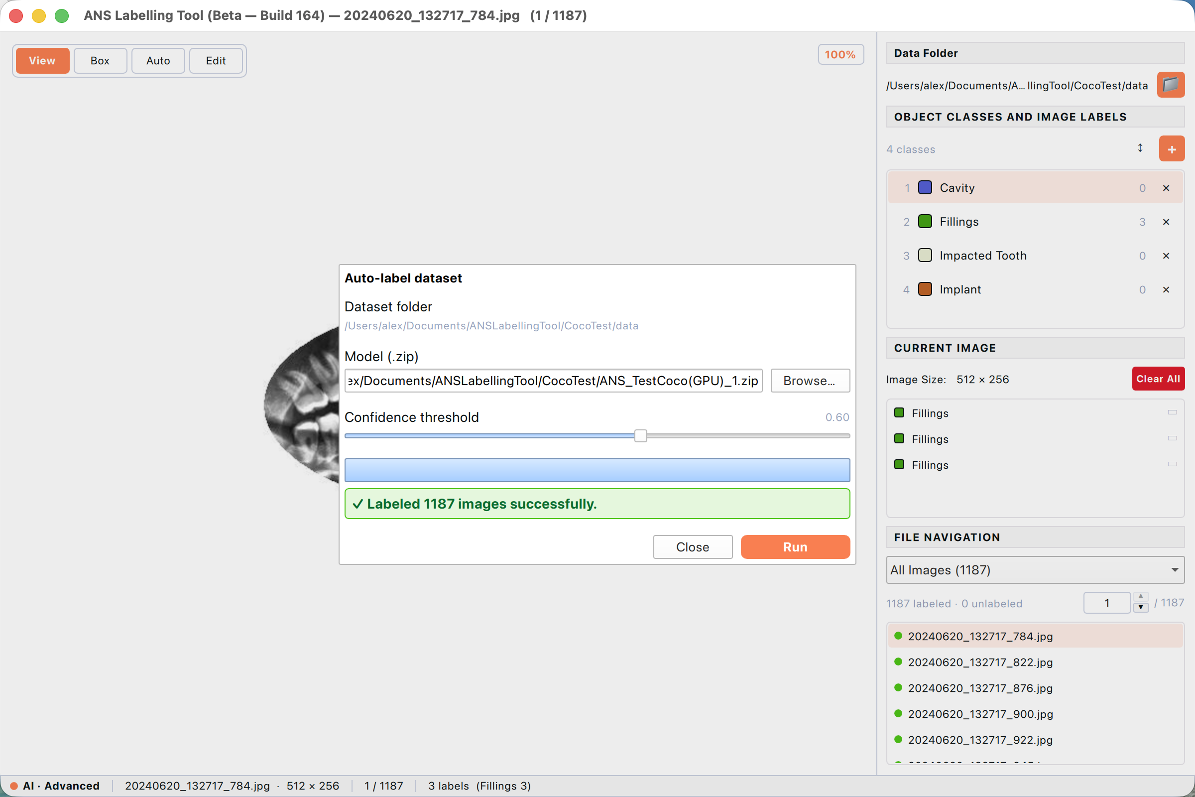 After ~1–2 minutes (GPU), the banner reports “Labeled 1187 images successfully” and the four model classes (Cavity, Fillings, Impacted Tooth, Implant) appear in the right panel.